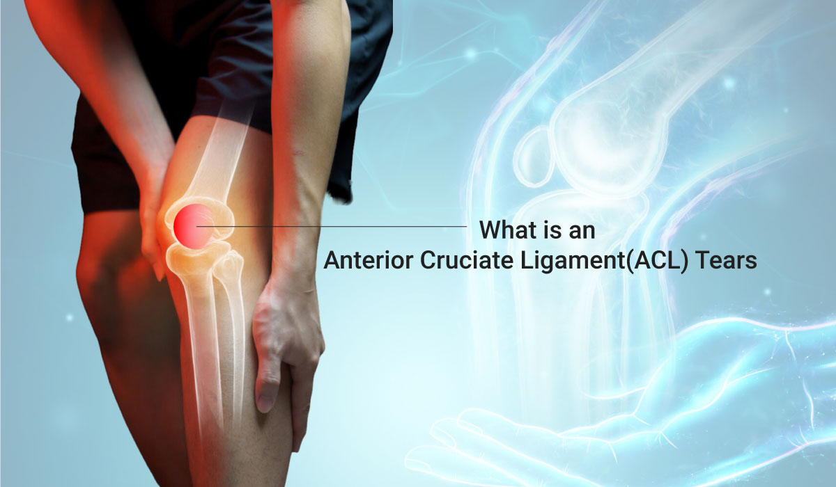 Cedera ACL: Kenapa Lutut Jadi Sulit Melurus dan Terasa Mau Copot?